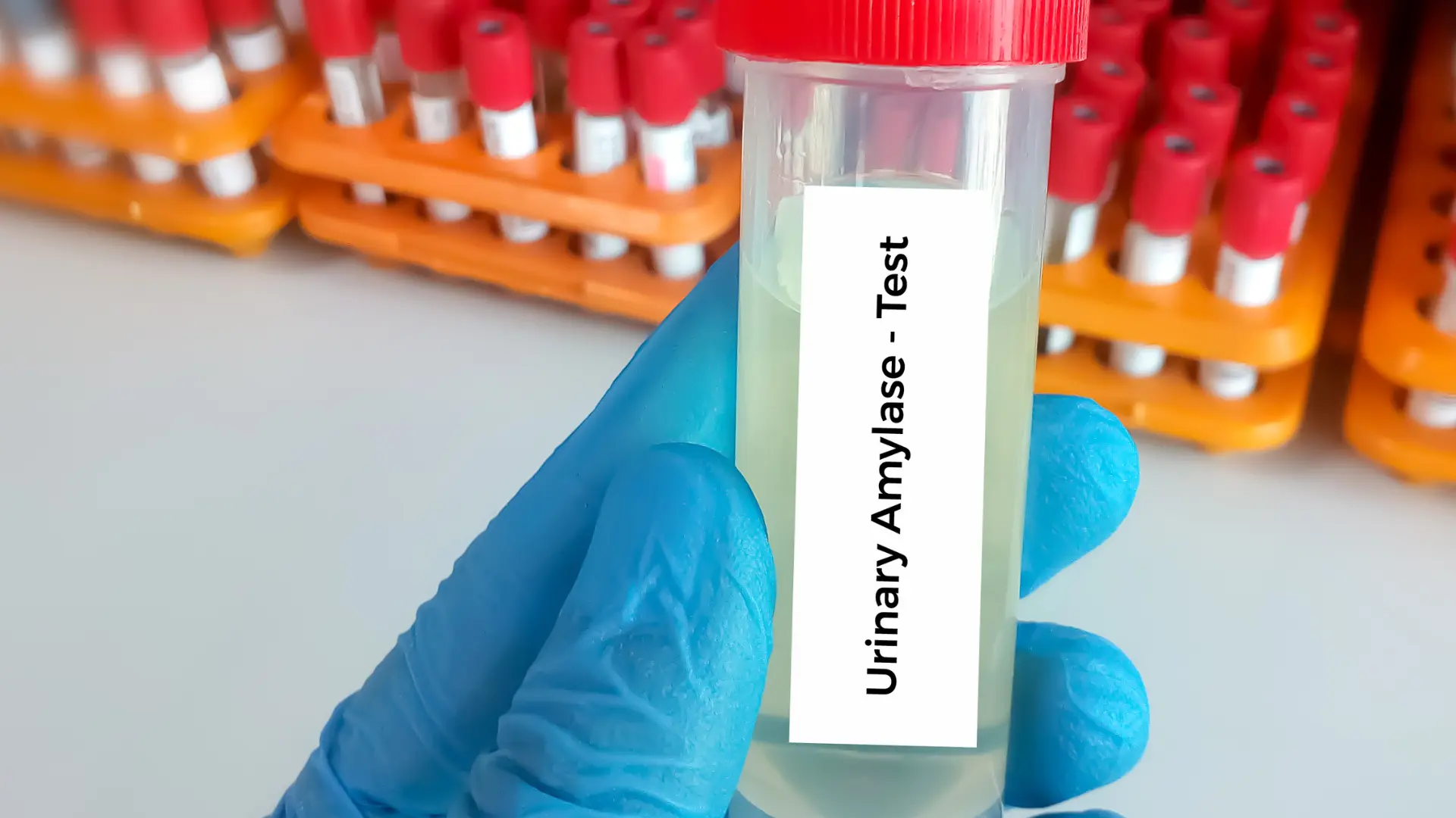 Amylase